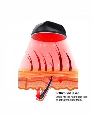 DKF-CAP LASER 308 DIODES